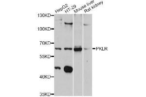 Western blot analysis of extracts of various cell lines, using PKLR antibody (ABIN5998532) at 1:3000 dilution. (PKLR 抗体)