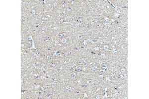 anti-Syntaxin Binding Protein 1 (STXBP1) (AA 184-216), (N-Term) antibody