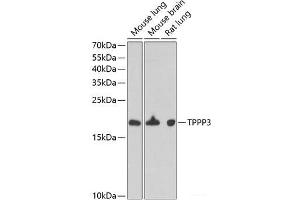 Western blot analysis of extracts of various cell lines using TPPP3 Polyclonal Antibody at dilution of 1:1000. (TPPP3 抗体)
