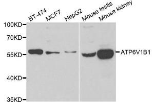 Western blot analysis of extracts of various cell lines, using ATP6V1B1 antibody. (ATP6V1B1 抗体)