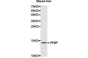 Western Blotting (WB) image for anti-Pro-Platelet Basic Protein (Chemokine (C-X-C Motif) Ligand 7) (PPBP) antibody (ABIN1874208) (CXCL7 抗体)