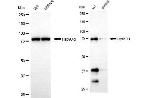 Western blotting analysis using cyclin T1 antibody (ABIN7798203). (Recombinant Cyclin T1 抗体)