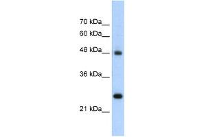 WB Suggested Anti-CHGA Antibody Titration:  5. (Chromogranin A 抗体  (N-Term))