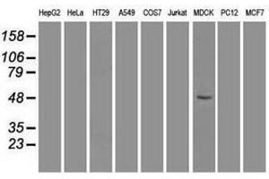 Image no. 2 for anti-Forkhead Box A1 (FOXA1) antibody (ABIN1498292) (FOXA1 抗体)