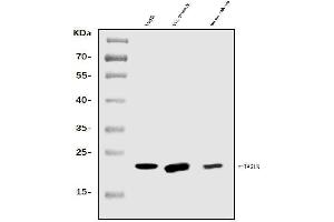 Western blot analysis of TAGLN/Transgelin using anti-TAGLN/Transgelin antibody (ABIN7600099). (Transgelin 抗体  (AA 15-170))