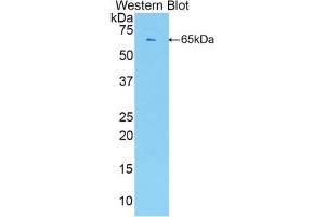 Western blot analysis of the recombinant protein. (ESM1 抗体  (AA 22-184))