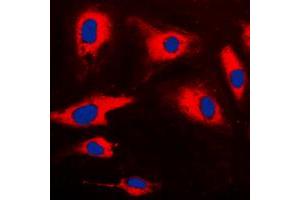 Immunofluorescent analysis of CARD14 staining in HeLa cells. (CARD14 抗体  (Center))