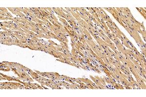 Detection of HIF1a in Rat Cardiac Muscle Tissue using Polyclonal Antibody to Hypoxia Inducible Factor 1 Alpha (HIF1a) (HIF1A 抗体  (AA 216-336))