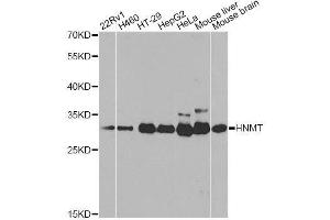 Western blot analysis of extracts of various cell lines, using HNMT antibody. (HNMT 抗体  (AA 1-292))