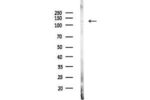anti-SET Domain, Bifurcated 2 (SETDB2) (N-Term) antibody