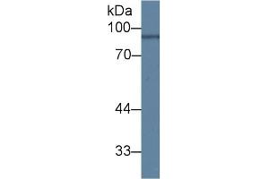 Detection of ANG in Mouse Brain lysate using Polyclonal Antibody to Angiostatin (ANG) (Angiostatin 抗体  (AA 79-466))