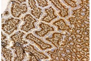 ABIN6259966 and ABIN6272936 at 1/100 staining Rat colon tissue by IHC-P. (AP3B1 抗体  (C-Term))