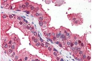 Human Prostate (formalin-fixed, paraffin-embedded) stained with DRAM antibody ABIN351449 at 3 ug/ml followed by biotinylated goat anti-rabbit IgG secondary antibody ABIN481713, alkaline phosphatase-streptavidin and chromogen. (DRAM 抗体  (N-Term))