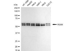 anti-Regulator of G-Protein Signaling 6 (RGS6) antibody