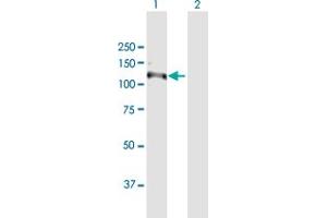 Western Blot analysis of RNF111 expression in transfected 293T cell line by RNF111 MaxPab polyclonal antibody. (RNF111 抗体  (AA 1-985))