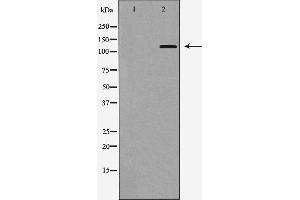 Western blot analysis of Integrin αE expression in HepG2 cells,The lane on the left is treated with the antigen-specific peptide.