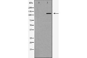 Western blot analysis of Integrin αE expression in HepG2 cells,The lane on the left is treated with the antigen-specific peptide. (CD103 抗体  (N-Term))