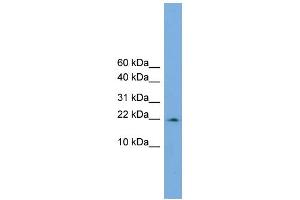 WB Suggested Anti-PPIL3  Antibody Titration: 0. (PPIL3 抗体  (Middle Region))