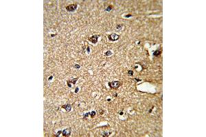Immunohistochemistry (IHC) image for anti-Peptidylprolyl Isomerase A (Cyclophilin A) (PPIA) antibody (ABIN3001732) (PPIA 抗体)