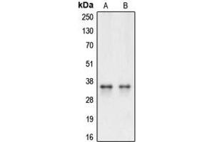 Western blot analysis of Caspase 3 expression in HeLa (A), Raw264. (Caspase 3 抗体  (Center))