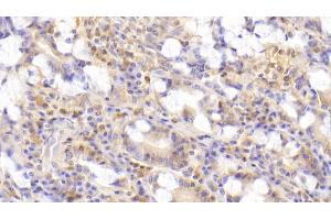 Detection of GIP in Human Small intestine Tissue using Polyclonal Antibody to Gastric Inhibitory Polypeptide (GIP) (GIP 抗体  (AA 22-153))