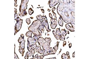 IHC analysis of DLAT using anti-DLAT antibody (ABIN7602307).
