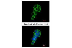 ICC/IF Image Immunofluorescence analysis of methanol-fixed HepG2, using PIGR, antibody at 1:200 dilution. (PIGR 抗体)