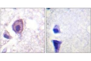 Immunohistochemistry analysis of paraffin-embedded human brain tissue, using CD4 (Ab-433) Antibody. (CD4 抗体  (AA 401-450))