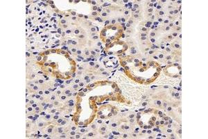 Immunohistochemistry (Paraffin-embedded Sections) (IHC (p)) image for anti-Transient Receptor Potential Cation Channel, Subfamily V, Member 5 (TRPV5) antibody (ABIN7075977)