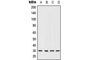 Western blot analysis of HOXC12 expression in MCF7 (A), ACHN (B), NIH3T3 (C), PC12 (D) whole cell lysates. (HOXC12 抗体  (Center))