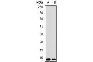 Western blot analysis of UBCH5 expression in SW620 (A), BT474 (B) whole cell lysates. (UBE2D1 抗体)