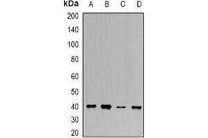 Western blot analysis of UROD expression in K562 (A), HepG2 (B), mouse liver (C), mouse kidney (D) whole cell lysates. (UROD 抗体)