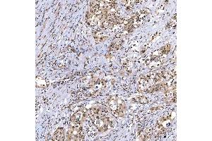 IHC analysis of SMARCA2/BRM using anti-SMARCA2/BRM antibody (ABIN7601969).