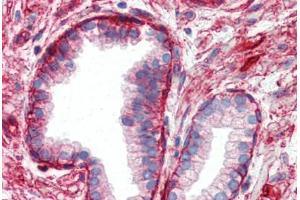 Human Prostate (formalin-fixed, paraffin-embedded) stained with ITGB1 antibody ABIN364254 at 10 ug/ml followed by biotinylated anti-mouse IgG secondary antibody ABIN481714, alkaline phosphatase-streptavidin and chromogen. (ITGB1 抗体)