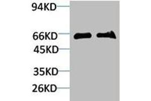 Western blot analysis of 1) Mouse Brain Tissue, 2)Rat Brain Tissue with GABA Transporter 1 Rabbit pAb diluted at 1:2,000. (SLC6A1 抗体)