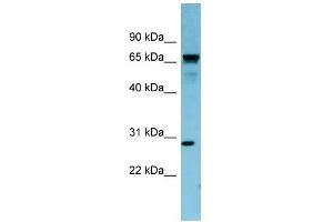 WB Suggested Anti-RASL12 Antibody Titration: 0. (RASL12 抗体  (N-Term))