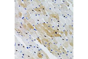 Immunohistochemistry (IHC) image for anti-Protein tyrosine Phosphatase, Non-Receptor Type 11 (PTPN11) (AA 514-593) antibody (ABIN3016707)