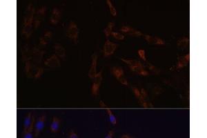 Immunofluorescence (IF) image for anti-Succinate-CoA Ligase, GDP-Forming, beta Subunit (SUCLG2) antibody (ABIN7264719)