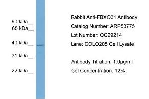 WB Suggested Anti-FBXO31  Antibody Titration: 0. (FBXO31 抗体  (Middle Region))