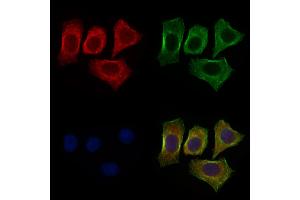 ABIN6264525 and ABIN6272534 staining HepG2 cells by IF/ICC.