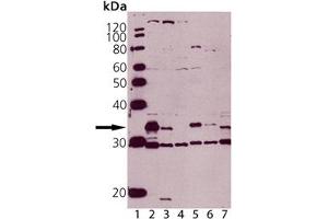 Western blot analysis of Caspase-3 pAb: Lane 1: MW Marker, Lane 2: Jurkat , Lane 3: Jurkat treated with staurosporine, Lane 4: MCF-7 (negative control), Lane 5: HeLa, (cell lysate) , Lane 6: Rat Spleen, Lane 7: Mouse Spleen. (Caspase 3 抗体)