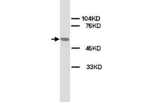 Western Blot analysis of CHRNA1 expression from rat skeletal muscle lyate with CHRNA1 polyclonal antibody . (CHRNA1 抗体  (N-Term))