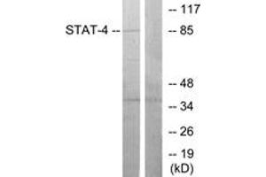 Western blot analysis of extracts from HeLa cells, using STAT4 (Ab-693) Antibody. (STAT4 抗体  (AA 660-709))