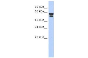 BLMH antibody used at 1 ug/ml to detect target protein. (BLMH 抗体  (Middle Region))