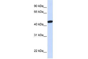 KRR1 antibody used at 1 ug/ml to detect target protein. (KRR1 抗体  (C-Term))