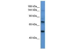 WB Suggested Anti-ASTN2 Antibody Titration:  0. (Astrotactin 2 抗体  (N-Term))
