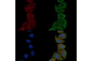 ABIN6259272 and ABIN6276054 staining Hela cells by IF/ICC.