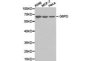 Western Blotting (WB) image for anti-Glucose-6-Phosphate Dehydrogenase (G6PD) antibody (ABIN1872757) (Glucose-6-Phosphate Dehydrogenase 抗体)