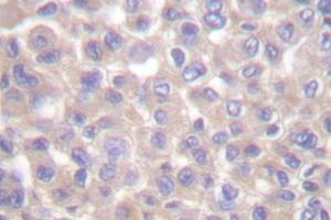 Image no. 2 for anti-TNFRSF1A-Associated Via Death Domain (TRADD) antibody (ABIN271966) (TRADD 抗体)