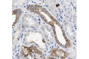 Annexin A3 Antibody for IHC in human kidney tissue (Annexin A3 抗体  (N-Term))